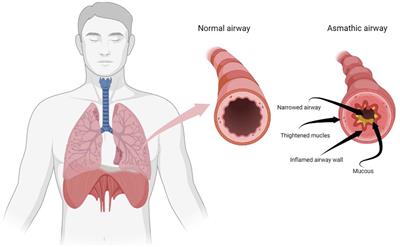 Basis of preventive and non-pharmacological interventions in asthma